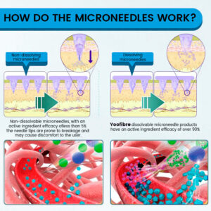 Yoofibre Next-Generation Pain-Free Injection Nano Microneedle Patch